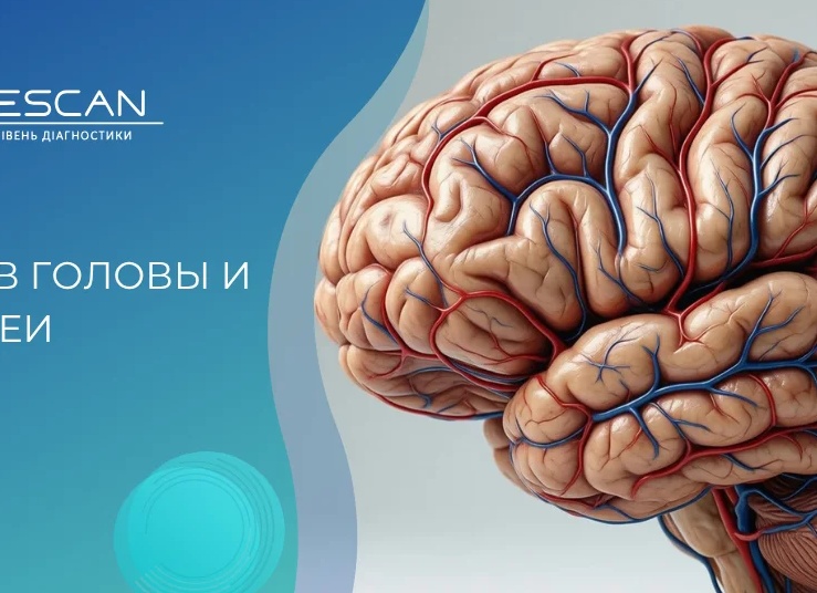 ВСЕ О КТ СОСУДОВ ТАЗА