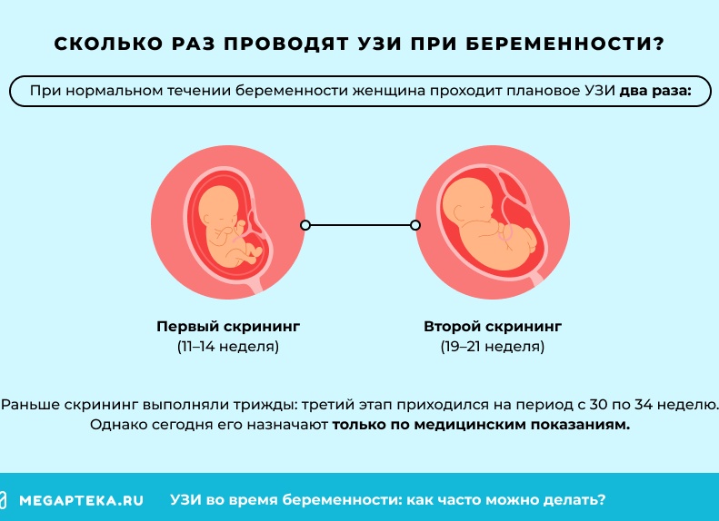 Как часто можно делать узи во время беременности? Есть ли ограничения?