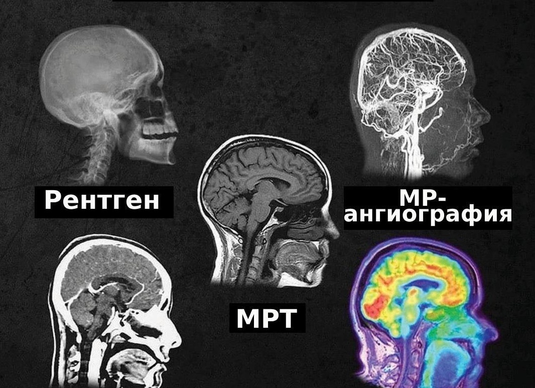 КТ, МРТ, ПЭТ – в чем разница?