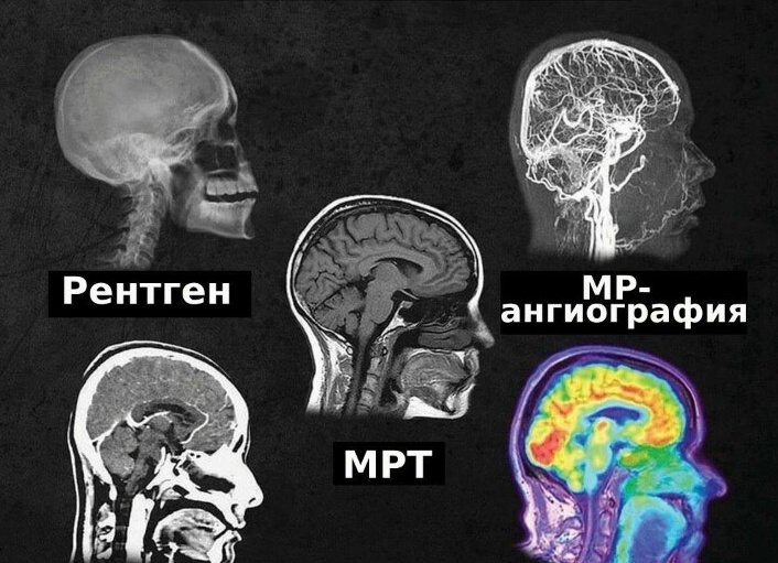 МРТ, КТ или УЗИ?