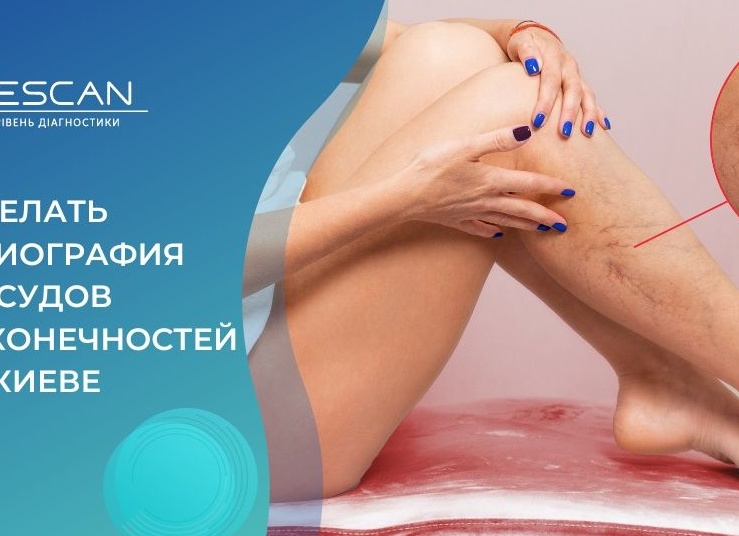 Все о КТ нижних конечностей